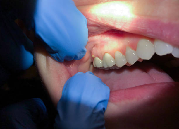Best Walk-In Emergency Dentist in Pontotoc, MS