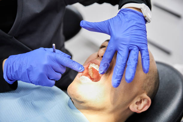 Best Emergency Tooth Extraction in Pontotoc, MS